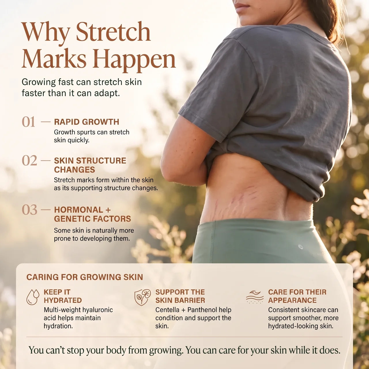 AERIKA™ Revitalizing Stretch Mark Serum