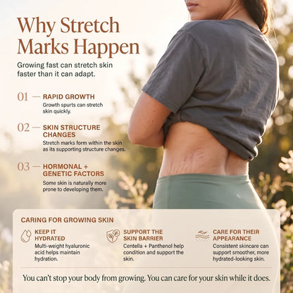 AERIKA™ Revitalizing Stretch Mark Serum