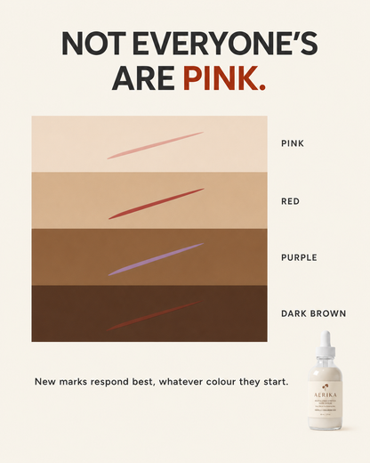 AERIKA™ Revitalizing Stretch Mark Serum